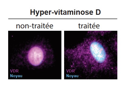 Immunodétection du récepteur de la Vitamine D (VDR) 